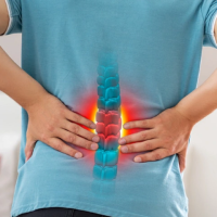 Trị liệu đau thắt lưng, thoái hóa cột sống