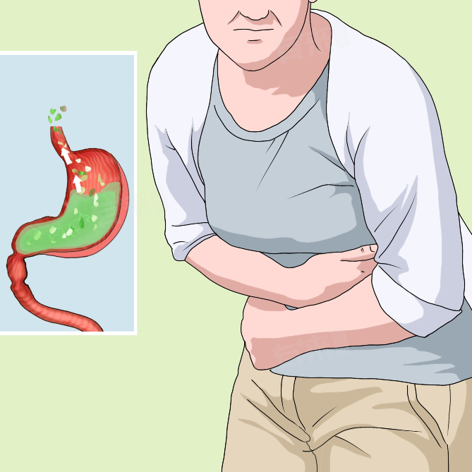 Thảo mộc trào ngược dạ dày thực quản viêm loét tá tràng 